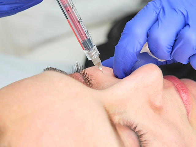 Mesotherapie Gesicht