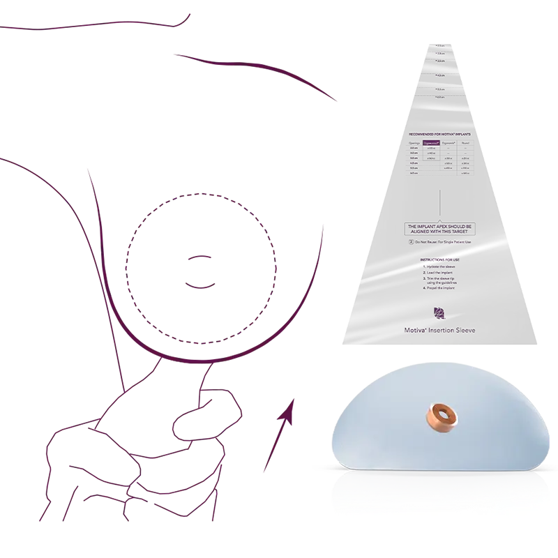 preservé brustvergrößerung ohne op