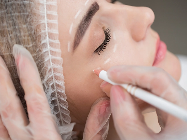 Blepharoplastik | Oberlidstraffung in Konstanz am Bodensee