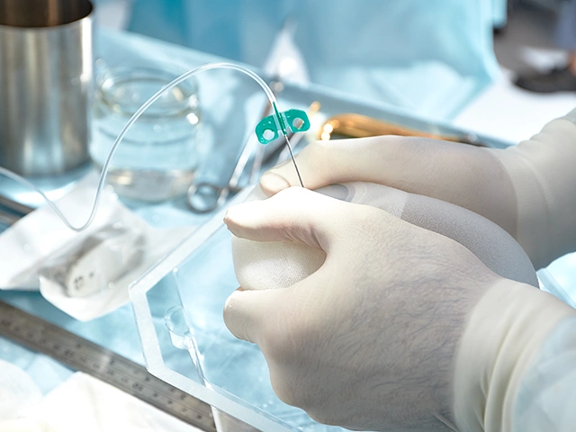 FAQs zur Brustvergrößerung mit Implantaten wie Kosten