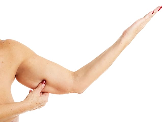 fettabsaugung oberarme, liposuktion arme, liposuktion arme kosten, liposuktion oberarme, fettabsaugung achsel, unterarm fett loswerden fettabsaugung oberarme, liposuktion arme, liposuktion arme kosten, liposuktion oberarme, fettabsaugung achsel, unterarm fett loswerden